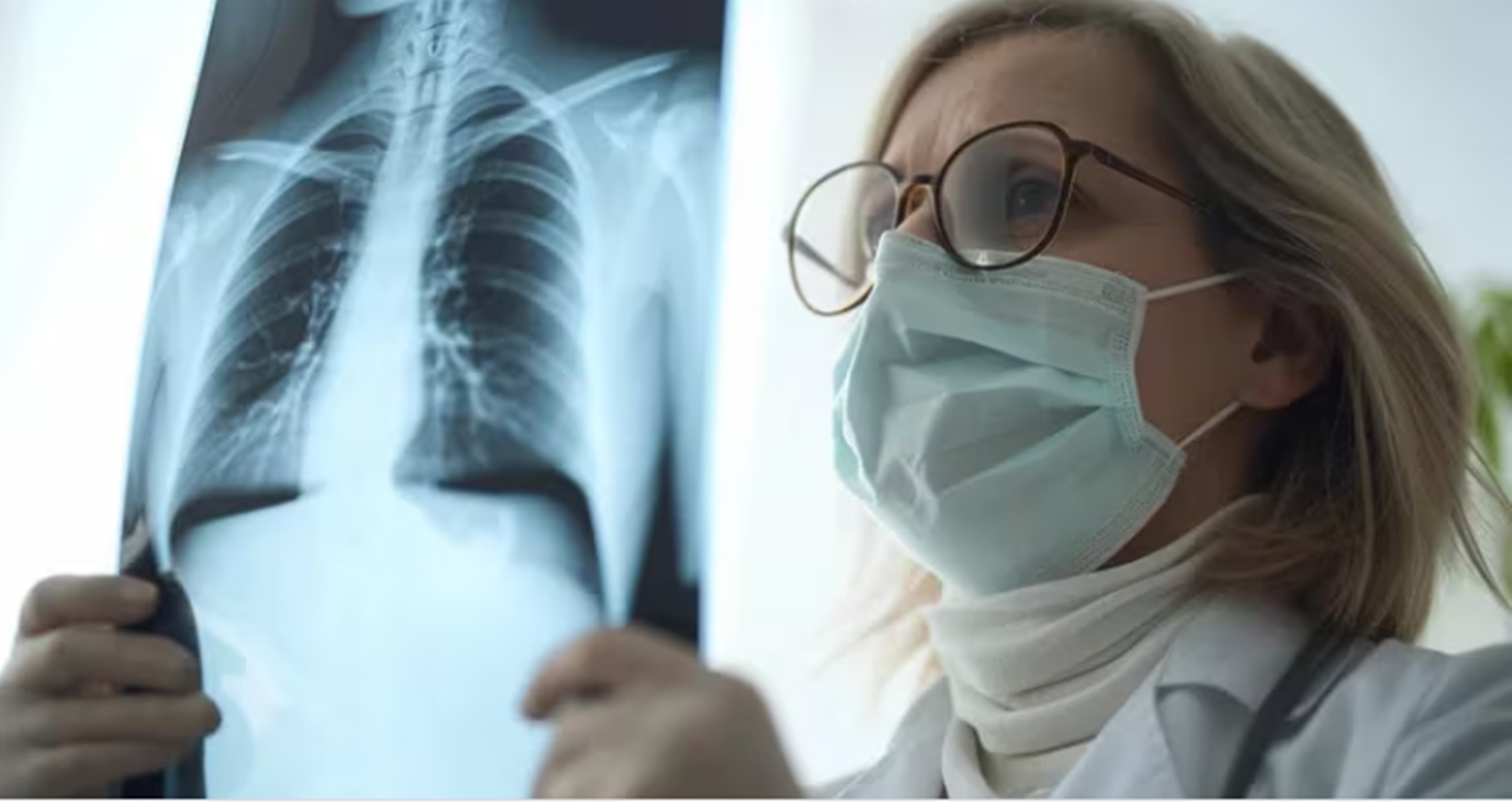 Cómo es el tratamiento para el cáncer de pulmón que prolonga la vida de los pacientes