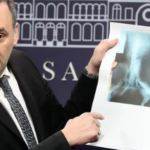 “La radiografía de un perro” : el Gobierno denunció irregularidades y corrupción en la aprobación de pensiones por discapacidad