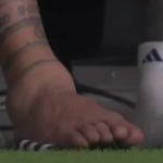 Impactante: la imagen del tobillo de Lionel Messi