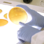 El aumento de infecciones causadas por una bacteria resistente y poco conocida alerta a los expertos