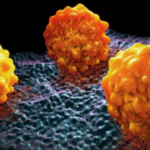 Científicos argentinos y españoles identifican una proteína clave en la lucha contra el cáncer de páncreas