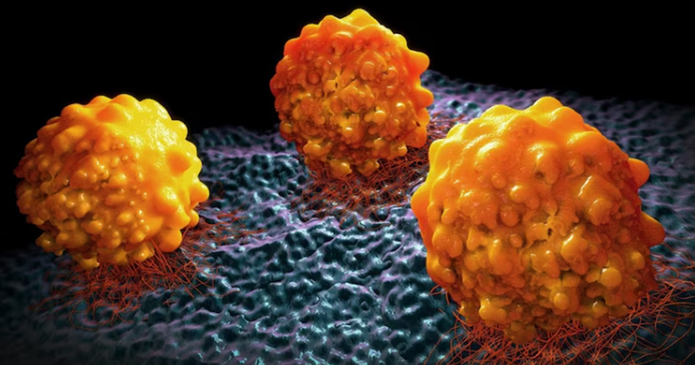 Científicos argentinos y españoles identifican una proteína clave en la lucha contra el cáncer de páncreas