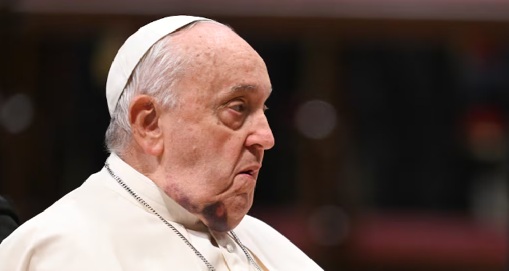 El Papa sufrió una caída y se golpeó la cara: la explicación oficial del Vaticano