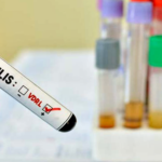 Concientizar para prevenir: charla abierta sobre sífilis